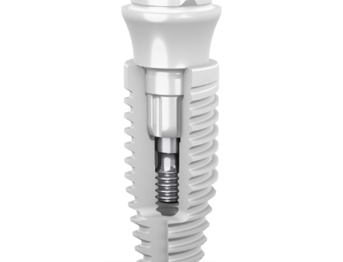 Implantes dentales de circonio en Leganés