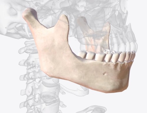 Pérdida de Hueso Dental: Causas, Síntomas y Tratamientos Regenerativos Más Avanzados